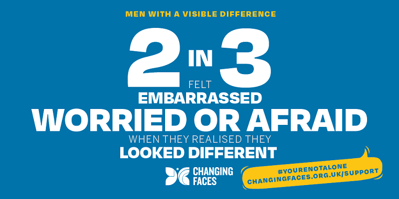 Changing Faces infographic saying 2 in 3 men with a visible difference feel embarrassed, worried or afraid