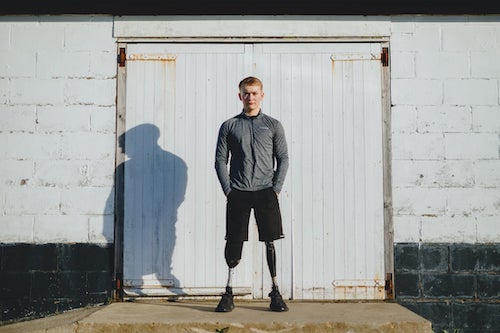 Billy Monger standing with his prosthetic legs